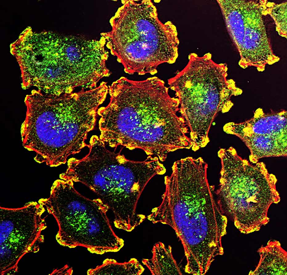 Cancer cells close up