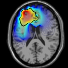 Gibin Brain Scan Image 