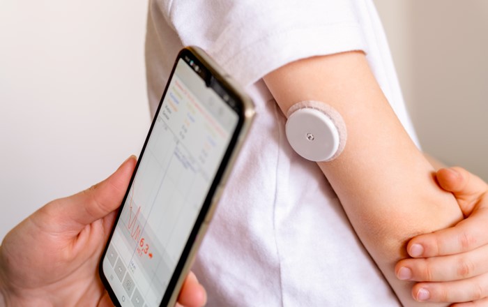 Continuous glucose monitoring system on child's arm being checked on a smartphone.