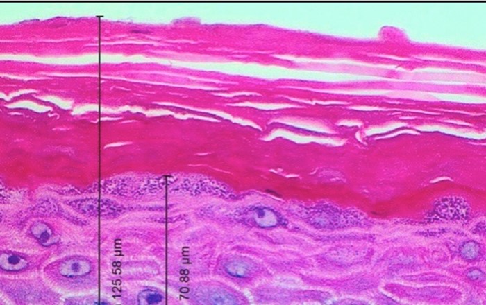 Cross-section through reconstructed human skin, cultured in the laboratory, used to test the safety of products applied to the skin. Research by the Swansea-led CALIN project, which works closely with companies. 
