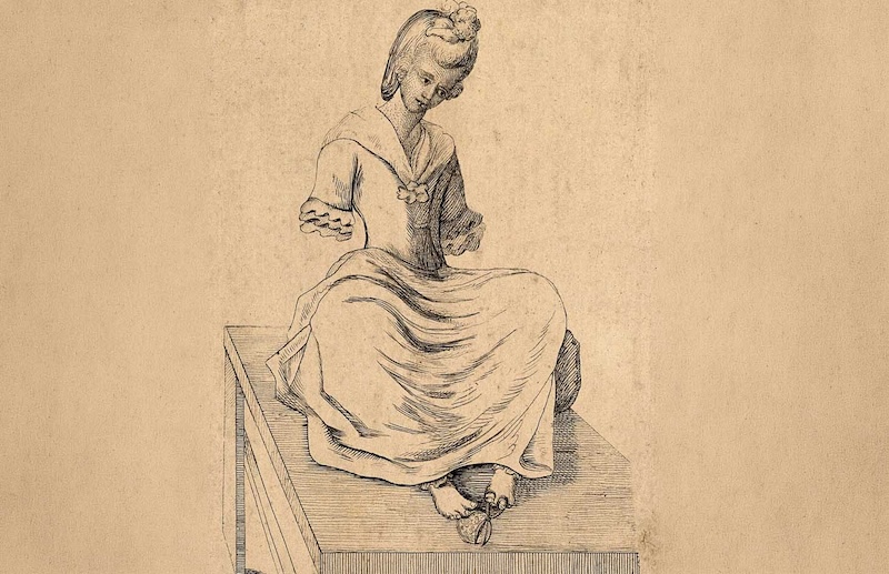 Image Credit: Miss Hawtin, born without arms. Etching. Wellcome Collection.