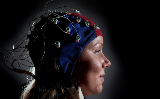 Skull cap for monitoring electrical signals. 